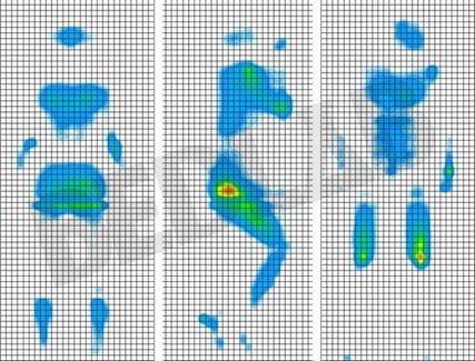 Test de soulagement de la pression et adaptabilite 1